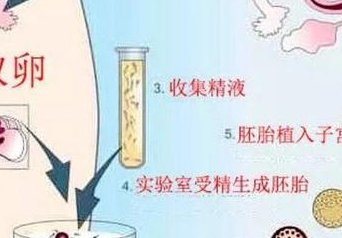 卵巢早衰还可以做试管婴儿吗？高龄得了卵巢早衰能做试管吗？