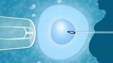 《妇产科》曾发表：少精弱精可能会揭示您试管反复流产原因-美国试管婴儿