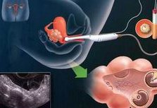 北京地区有哪些私立的机构可以做试管技术？做试管婴儿会出现哪些不良反应？